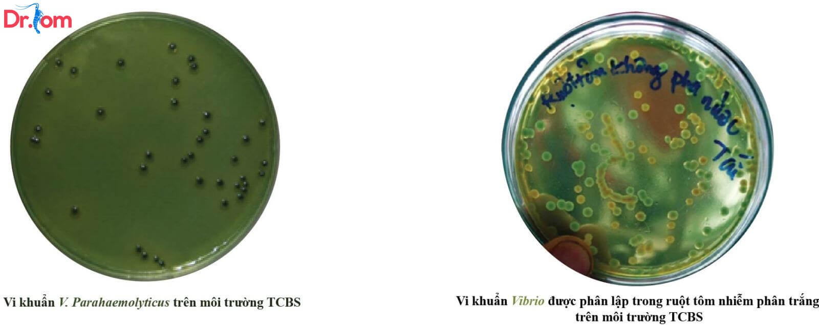 Phát hiện vi khuẩn Vibrio trên đĩa thạch TCBS