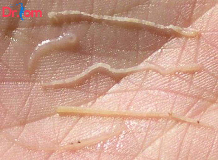 Bệnh phân trắng - Bệnh tôm phổ biến trên tôm